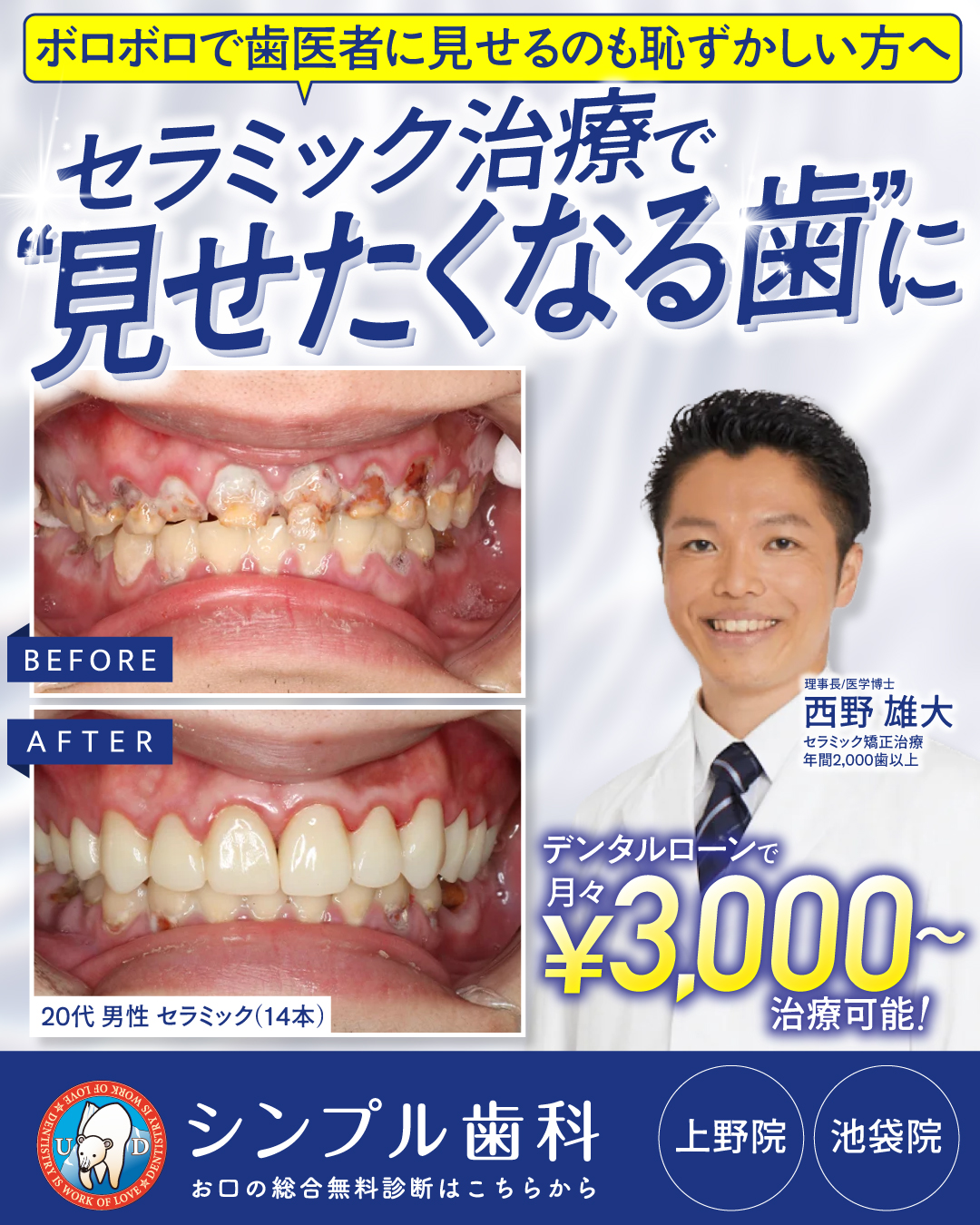 シンプル歯科様の広告クリエイティブ